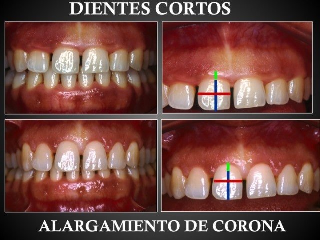 gaceta dental