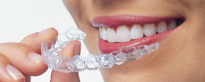 Invisalign